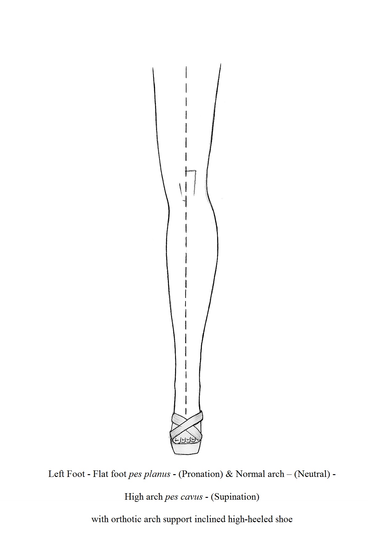 flats for high arches
